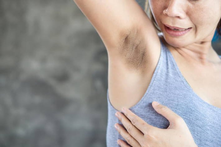 Cuatro-productos-naturales-que-le-permiten-aclarar-zonas-oscuras-de-su-piel